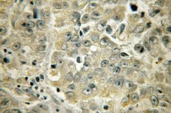 ACAA1 Rabbit anti-Human, Mouse, Rat, Polyclonal, Proteintech 150 &mu;L;