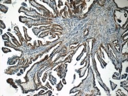 ACAA1 Rabbit anti-Human, Mouse, Rat, Polyclonal, Proteintech 150 &mu;L;