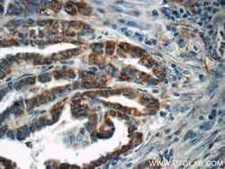ACAA1 Rabbit anti-Human, Mouse, Rat, Polyclonal, Proteintech 150 &mu;L;