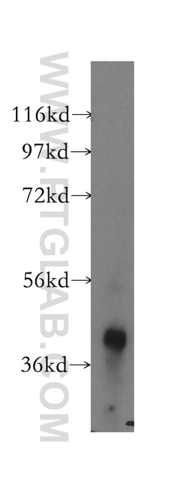 ACAA1 Rabbit anti-Human, Mouse, Rat, Polyclonal, Proteintech 150 &mu;L;