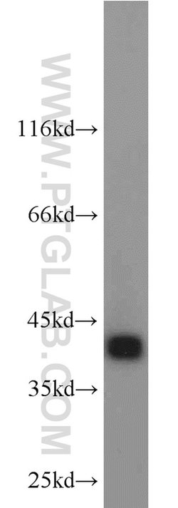 ACAA1 Rabbit anti-Human, Mouse, Rat, Polyclonal, Proteintech 150 &mu;L;