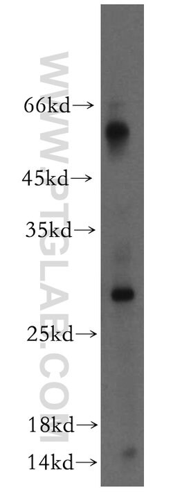 TIMP-4 Rabbit anti-Human, Polyclonal, Proteintech 20 &mu;L; Unconjugated:Antibodies,