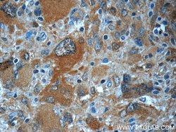 TIMP-4 Rabbit anti-Human, Polyclonal, Proteintech 20 &mu;L; Unconjugated:Antibodies,