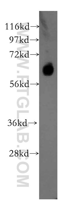 ARSG Rabbit anti-Human, Mouse, Rat, Polyclonal, Proteintech:Antibodies:Primary