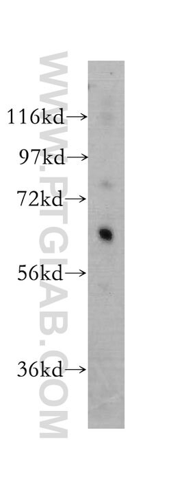 ARSG Rabbit anti-Human, Mouse, Rat, Polyclonal, Proteintech:Antibodies:Primary