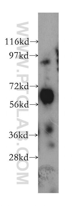 ARSG Rabbit anti-Human, Mouse, Rat, Polyclonal, Proteintech:Antibodies:Primary
