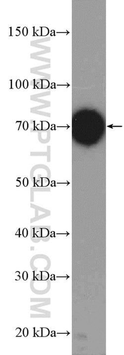 UBE3C Rabbit anti-Human, Mouse, Rat, Polyclonal, Proteintech 150 &mu;L;