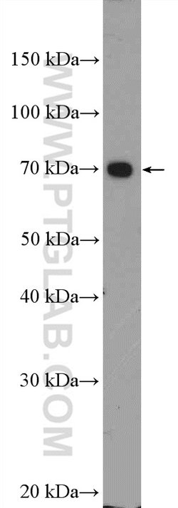 UBE3C Rabbit anti-Human, Mouse, Rat, Polyclonal, Proteintech 150 &mu;L;