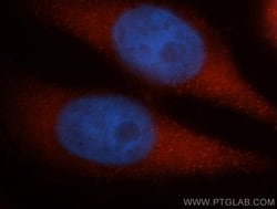 DYNC1H1 Rabbit anti-Human, Mouse, Rat, Zebrafish, Polyclonal, Proteintech:Antibodies:Primary