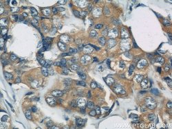 DYNC1H1 Rabbit anti-Human, Mouse, Rat, Zebrafish, Polyclonal, Proteintech:Antibodies:Primary