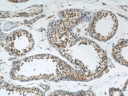 DYNC1H1 Rabbit anti-Human, Mouse, Rat, Zebrafish, Polyclonal, Proteintech:Antibodies:Primary