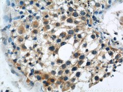 DYNC1H1 Rabbit anti-Human, Mouse, Rat, Zebrafish, Polyclonal, Proteintech:Antibodies:Primary