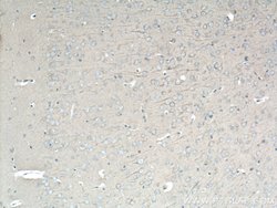DYNC1H1 Rabbit anti-Human, Mouse, Rat, Zebrafish, Polyclonal, Proteintech:Antibodies:Primary