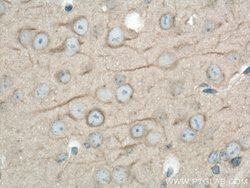 DYNC1H1 Rabbit anti-Human, Mouse, Rat, Zebrafish, Polyclonal, Proteintech:Antibodies:Primary