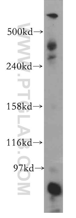 DYNC1H1 Rabbit anti-Human, Mouse, Rat, Zebrafish, Polyclonal, Proteintech:Antibodies:Primary