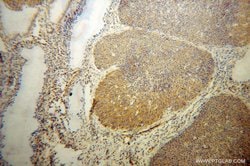 AKAP10 Rabbit anti-Human, Mouse, Rat, Polyclonal, Proteintech 150 &mu;L;