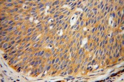 AKAP10 Rabbit anti-Human, Mouse, Rat, Polyclonal, Proteintech 150 &mu;L;