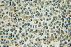 AKAP10 Rabbit anti-Human, Mouse, Rat, Polyclonal, Proteintech 150 &mu;L;