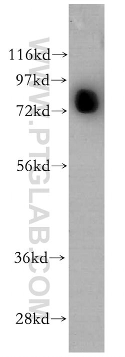 AKAP10 Rabbit anti-Human, Mouse, Rat, Polyclonal, Proteintech 150 &mu;L;