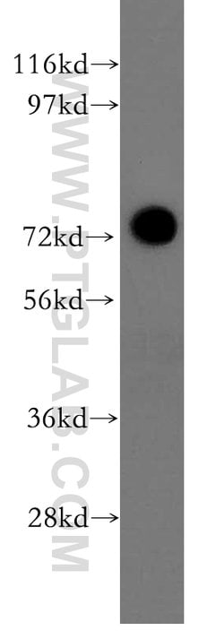 AKAP10 Rabbit anti-Human, Mouse, Rat, Polyclonal, Proteintech 150 &mu;L;