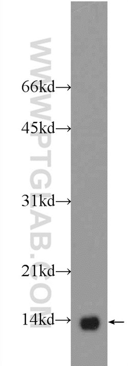 NDUFB3 Rabbit anti-Human, Mouse, Rat, Polyclonal, Proteintech 150 &mu;L;