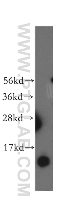 NDUFB3 Rabbit anti-Human, Mouse, Rat, Polyclonal, Proteintech 150 &mu;L;