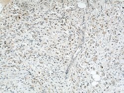 SYTL2 Rabbit anti-Human, Mouse, Rat, Polyclonal, Proteintech:Antibodies:Primary