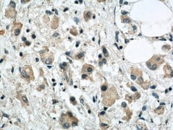 SYTL2 Rabbit anti-Human, Mouse, Rat, Polyclonal, Proteintech:Antibodies:Primary
