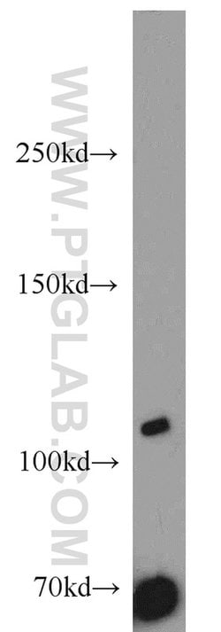 SYTL2 Rabbit anti-Human, Mouse, Rat, Polyclonal, Proteintech:Antibodies:Primary