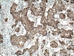 UQCRH Rabbit anti-Human, Mouse, Rat, Polyclonal, Proteintech 150 &mu;L;