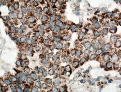 UQCRH Rabbit anti-Human, Mouse, Rat, Polyclonal, Proteintech 150 &mu;L;