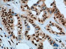 KPNA6 Rabbit anti-Human, Polyclonal, Proteintech 150 &mu;L; Unconjugated:Antibodies,