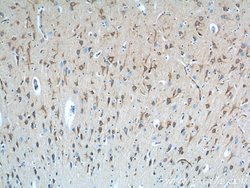 Sortilin Rabbit anti-Human, Mouse, Rat, Polyclonal, Proteintech:Anticorps:Anticorps