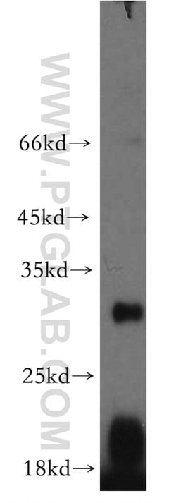 EBI3 Rabbit anti-Human, Polyclonal, Proteintech:Antikörper:Primärantikörper