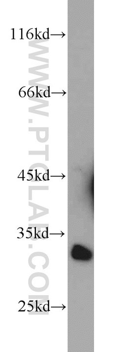 CA8 Rabbit anti-Human, Mouse, Rat, Polyclonal, Proteintech 150 &mu;L; Unconjugated:Antibodies,