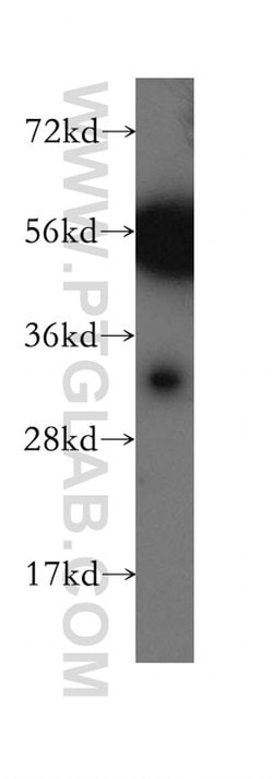 CA8 Rabbit anti-Human, Mouse, Rat, Polyclonal, Proteintech 150 &mu;L; Unconjugated:Antibodies,