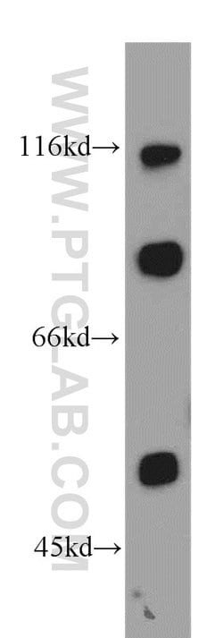 SGCE Rabbit anti-Human, Mouse, Rat, Polyclonal, Proteintech 150 &mu;L;