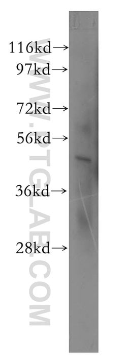 SGCE Rabbit anti-Human, Mouse, Rat, Polyclonal, Proteintech 150 &mu;L;