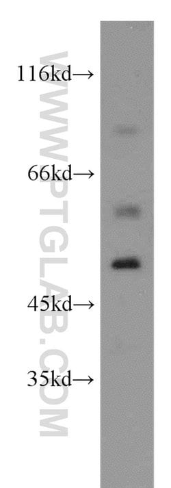 SGCE Rabbit anti-Human, Mouse, Rat, Polyclonal, Proteintech 150 &mu;L;