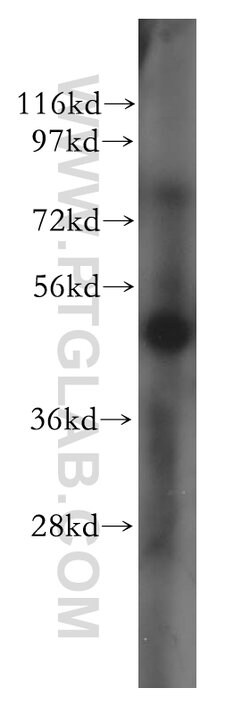 SGCE Rabbit anti-Human, Mouse, Rat, Polyclonal, Proteintech 150 &mu;L;