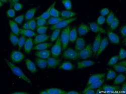 GSTM1 Rabbit anti-Human, Mouse, Polyclonal, Proteintech 150 &mu;L; Unconjugated:Antibodies,