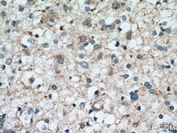 GSTM1 Rabbit anti-Human, Mouse, Polyclonal, Proteintech 150 &mu;L; Unconjugated:Antibodies,