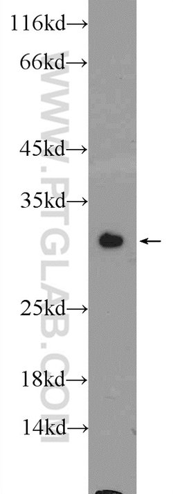 GSTM1 Rabbit anti-Human, Mouse, Polyclonal, Proteintech 150 &mu;L; Unconjugated:Antibodies,