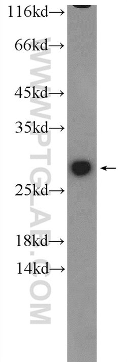 GSTM1 Rabbit anti-Human, Mouse, Polyclonal, Proteintech 150 &mu;L; Unconjugated:Antibodies,