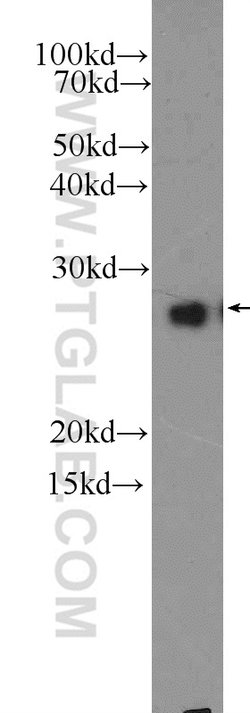 GSTM1 Rabbit anti-Human, Mouse, Polyclonal, Proteintech 150 &mu;L; Unconjugated:Antibodies,