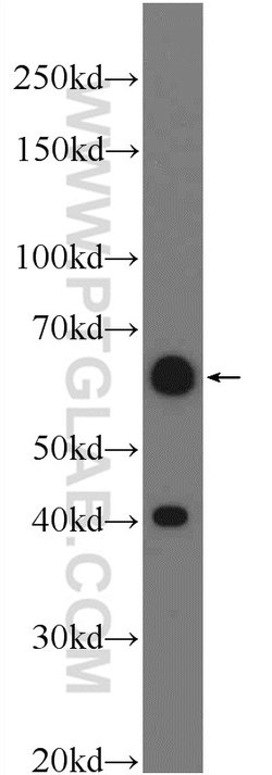 TEAD4 Rabbit anti-Human, Mouse, Rat, Polyclonal, Proteintech:Antibodies:Primary