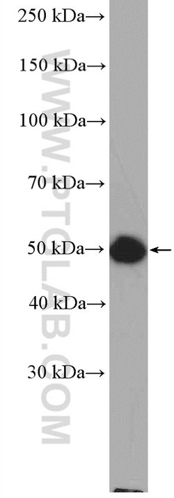 SEPT10 Rabbit anti-Human, Mouse, Rat, Polyclonal, Proteintech 150 &mu;L;