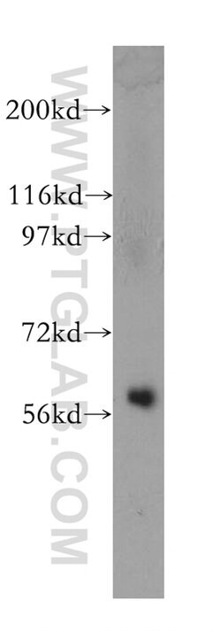SEPT10 Rabbit anti-Human, Mouse, Rat, Polyclonal, Proteintech 150 &mu;L;