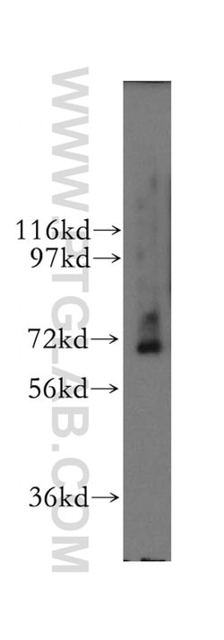 RNGTT Rabbit anti-Human, Mouse, Rat, Polyclonal, Proteintech:Antibodies:Primary