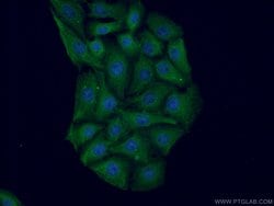 HOMER1 Rabbit anti-Human, Mouse, Rat, Polyclonal, Proteintech:Antibodies:Primary